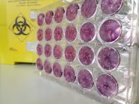 Master in virologia ambientale: 15 esperti per fronteggiare i futuri rischi pandemici